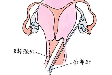 http://ningbo.huochezhan.net/post/205.html|宁波供卵助孕