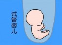 培养宁波捐卵宝宝艺术细胞的小技巧